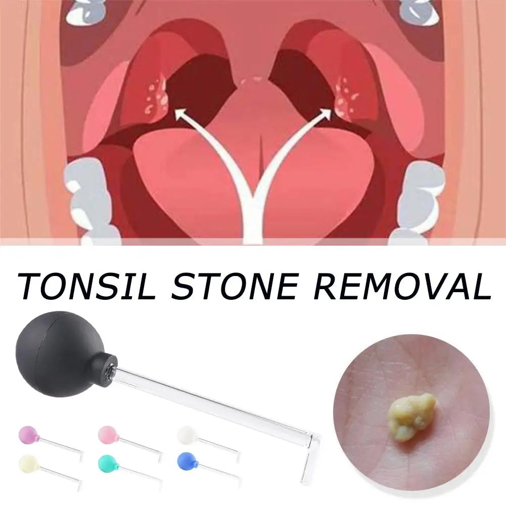 1pc Tonsil Stone Remover Tool Manual Style Remover Wax Care Cleaning Tools Mouth Tool Stone Ear Tonsil Remover Cleaning Q6M7