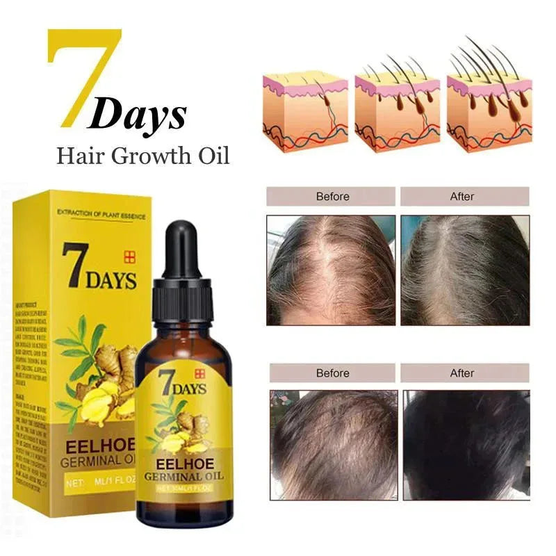 5pcs 7 Days Fast Ginger Hair Growth Serum Anti Hair Loss Fast Growing Hair Care Essential Oil Repair Damaged For Women Men 200ML