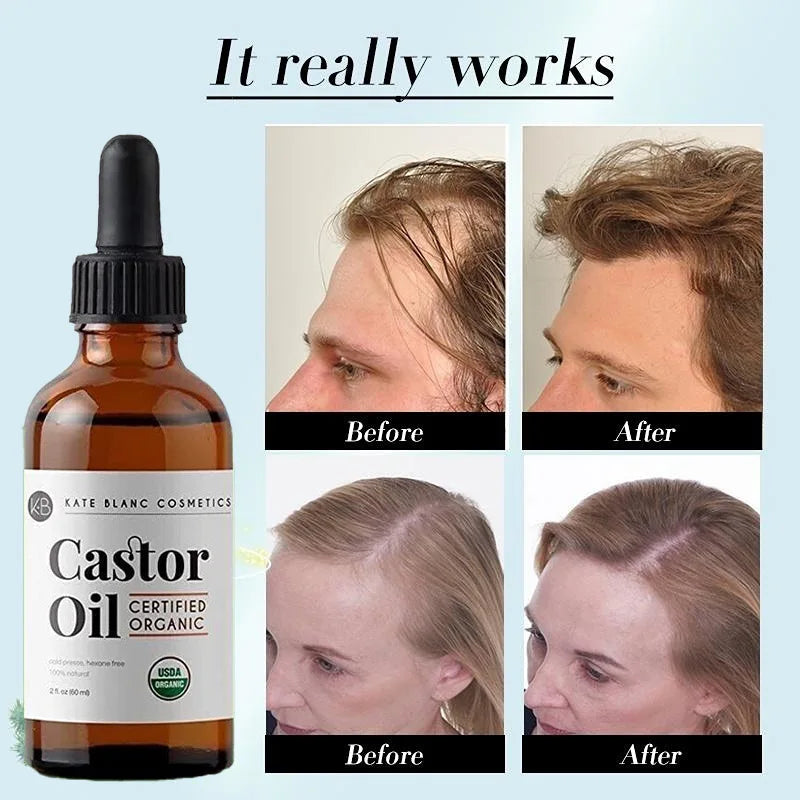 Castor Oil Prevents Hair Loss Stimulate Eyelashes Eyebrows Hair Growth Moisturize Skin Care Hair Growth Products Beauty Health