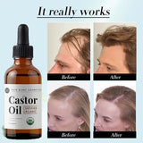 Castor Oil Prevents Hair Loss Stimulate Eyelashes Eyebrows Hair Growth Moisturize Skin Care Hair Growth Products Beauty Health