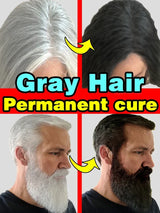 Gray Hair Treatment Serum White to Black Natural Color Repair Nourishing Products Anti-Hair Loss Care Men Women