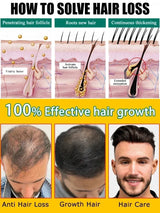 Rapid hair growth essential oil, repair baldness