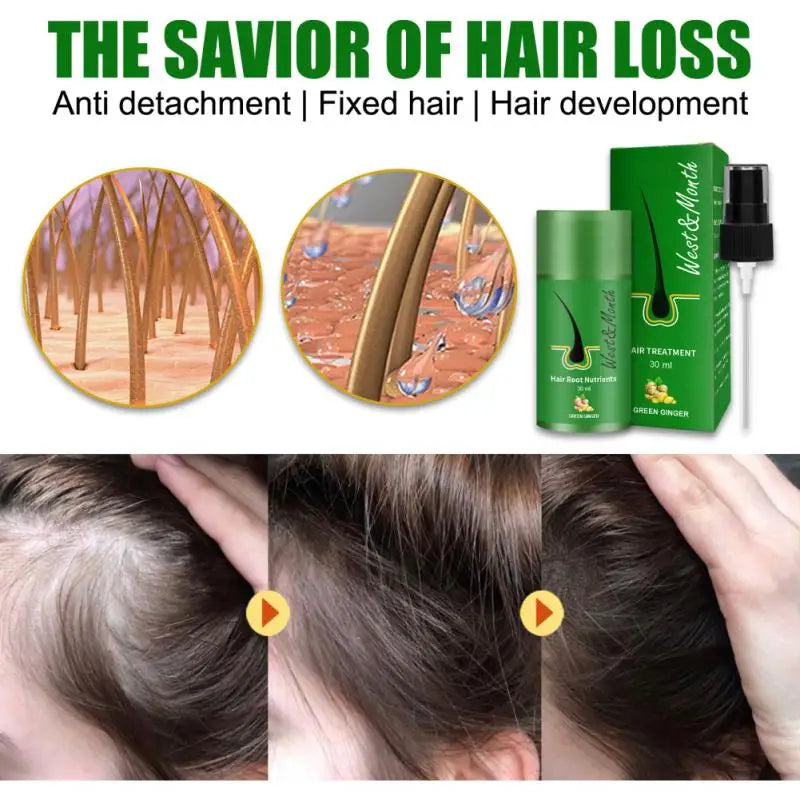 Natural Hair Growth Thickener Regrowth Serum Oil Fast Grow Hair for Hair Loss Care Products Men & Women