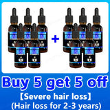 Hair growth essence can quickly grow hair and effectively repair baldness, alopecia areata, hereditary hair loss, postpartum hai