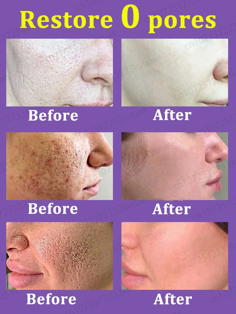 pores remover pore shrinking serum shrink Tightening Minimizing