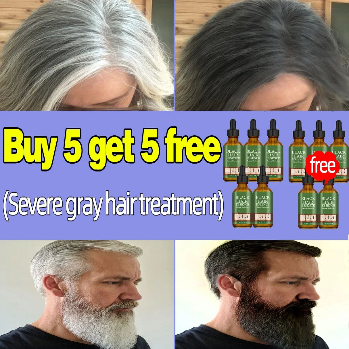 Gray Hair Treatment Serum White to Black Natural Color Repair Nourishing Products Anti-Hair Loss Care Men Women