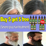 Gray Hair Treatment Serum White to Black Natural Color Repair Nourishing Products Anti-Hair Loss Care Men Women