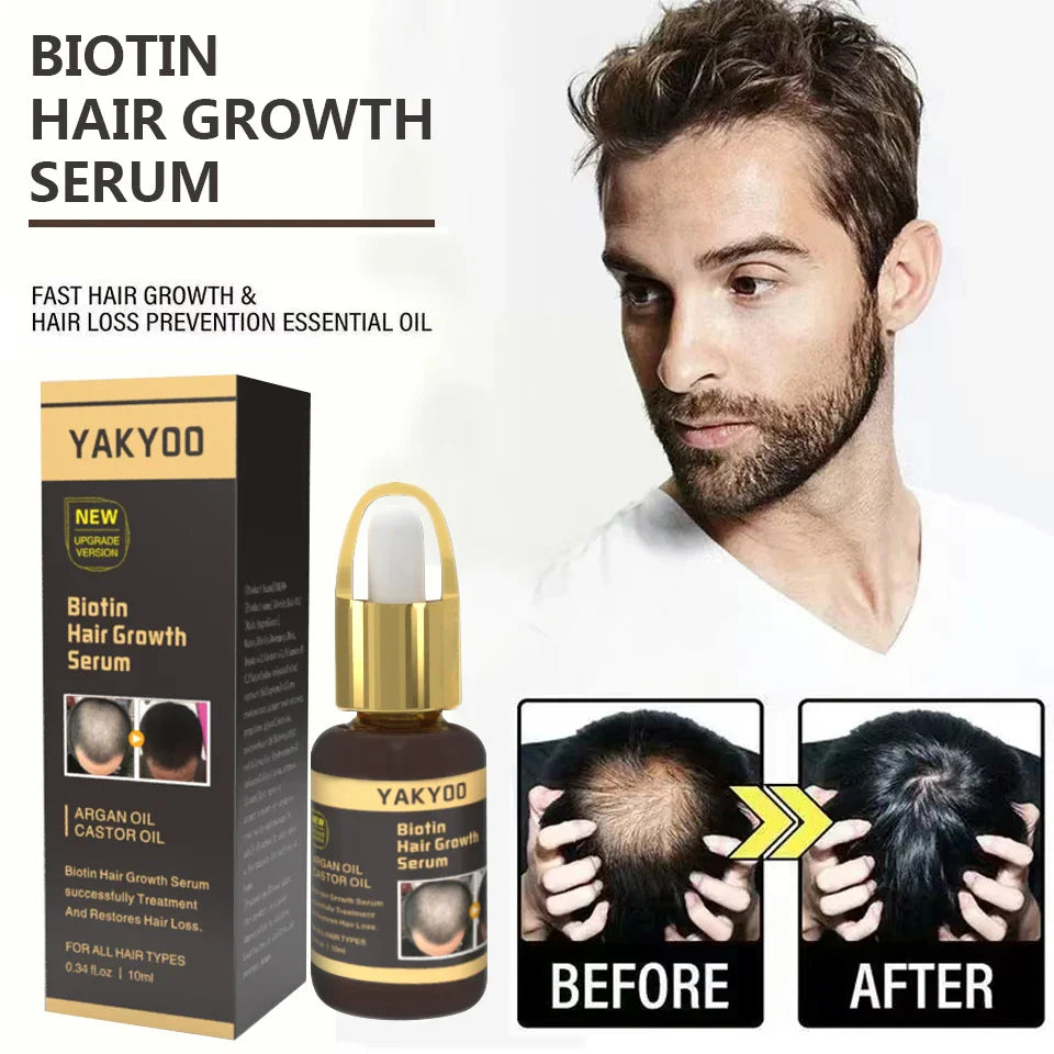 Fast Hair Growth Hair Follicle Treatment Hair Growth Seborrheic Alopecia Hairline Upward Postpartum Hair Loss Baldness Hair Loss