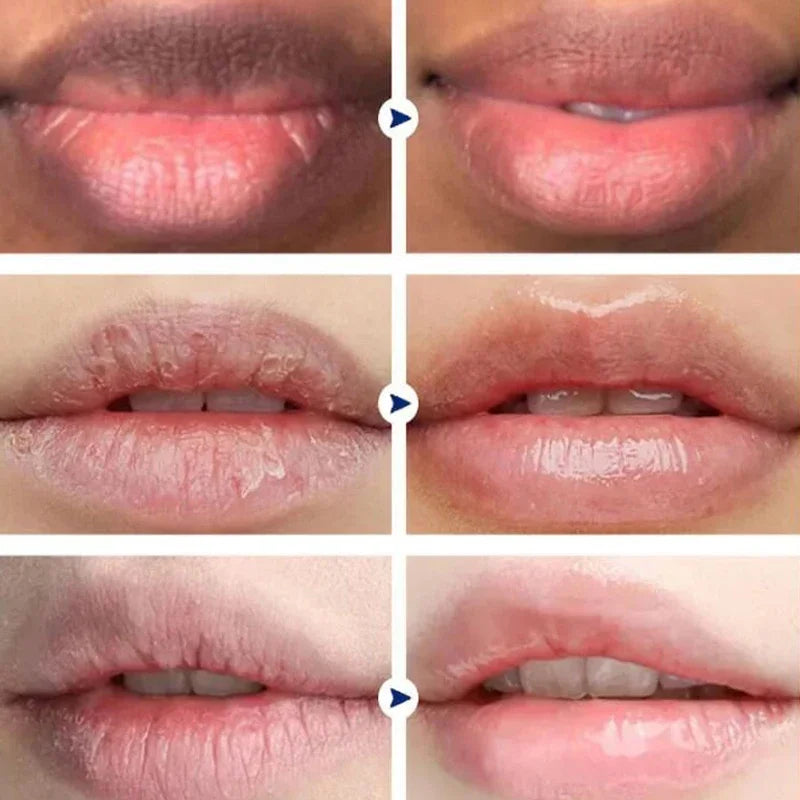 New Lip Balm Remove Dark Lightening Melanin Mask Gloss Oil Exfoliating Clean Moisturizing Care Products Makeup Lip Beauty Health