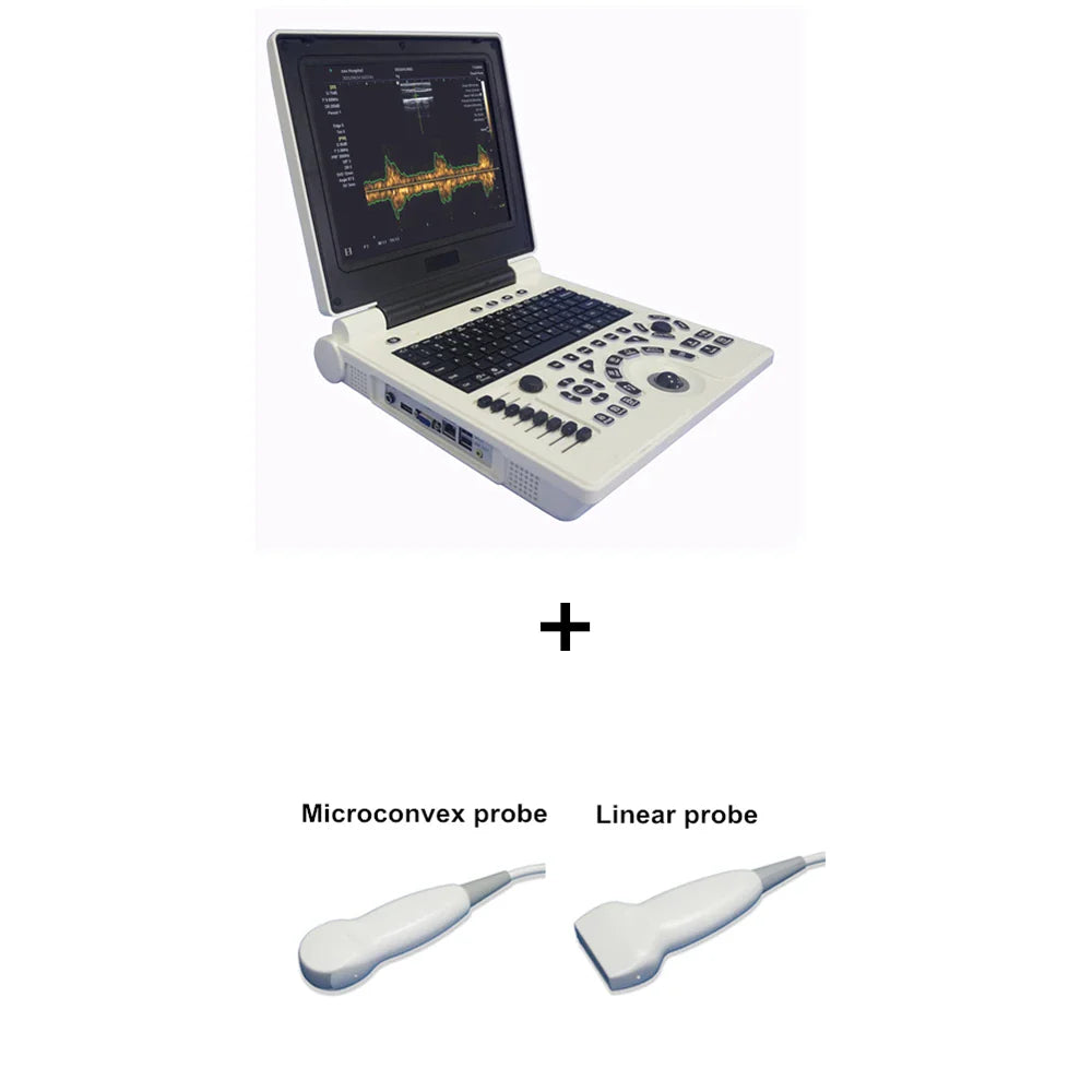 3D Based 12 Inch Notebook Black White Ultrasound Scanner PW Echo Machine