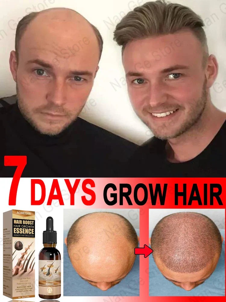 Unisex Hair Growth Oil Hair Loss Treatment Rapid Hair Growth Effective Baldness Repair Hereditary Postpartum Hair Loss