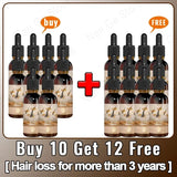 Unisex Hair Growth Oil Hair Loss Treatment Rapid Hair Growth Effective Baldness Repair Hereditary Postpartum Hair Loss