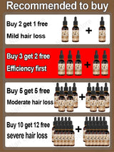 Unisex Hair Growth Oil Hair Loss Treatment Rapid Hair Growth Effective Baldness Repair Hereditary Postpartum Hair Loss