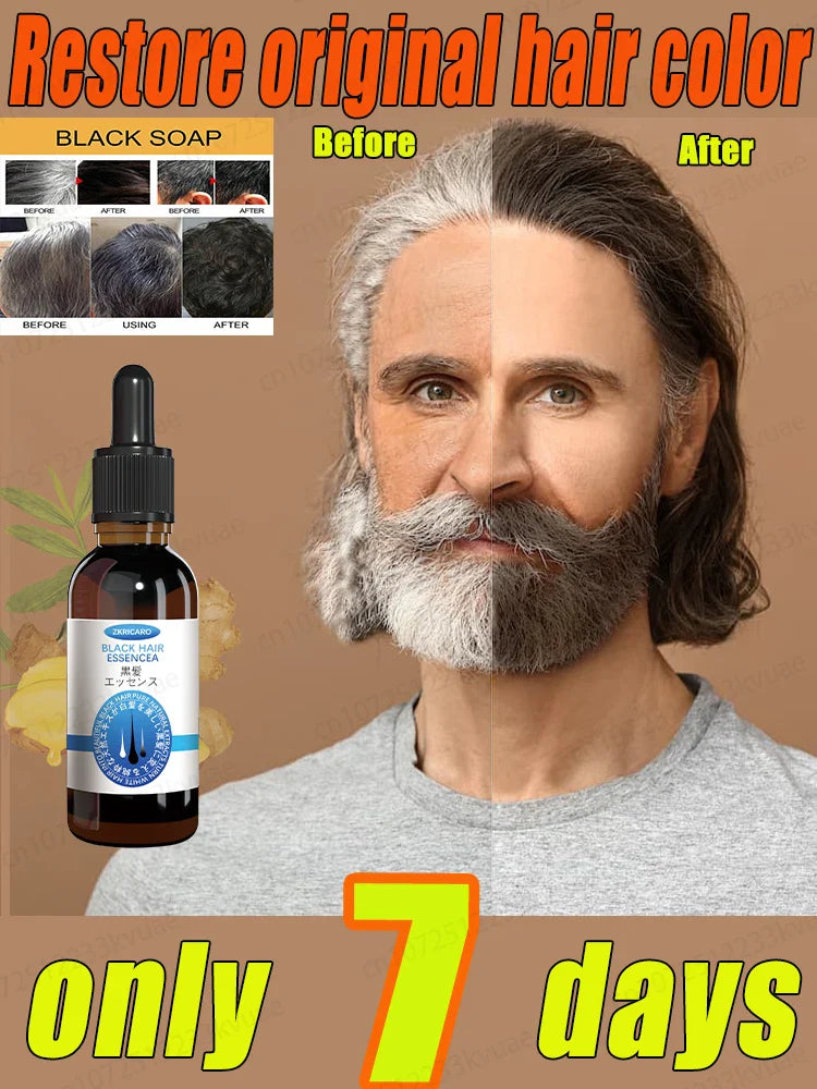 White hair killer, remove gray hair and restore natural hair color in 7 days