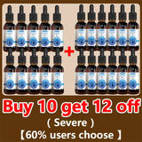 White hair killer, remove gray hair and restore natural hair color in 7 days