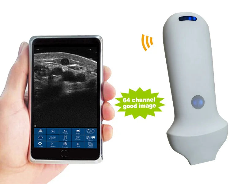 Wireless Ultrasound Probe scanner portable Bluetooth machine WIFI ultrasound scanner Machine support iOS Android Windows