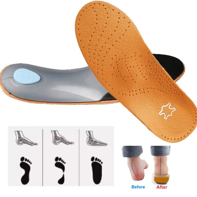 cowhide Shoes Insole Leather Orthotic Insoles Flat Feet High Arch Support Orthopedic Shoes Sole Fit In O/X Leg Corrected Insert